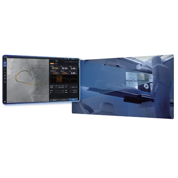 Coronary-Angiography-Analysis-Solution